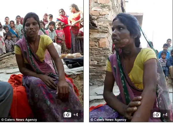 22-Year-Old Woman Tortured By Her Husband Over Suspicion Of Having An Affair. Photos